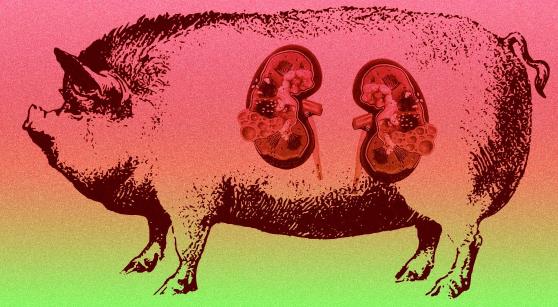 Human Cells Used to Grow Kidneys in Pigs for the First Time