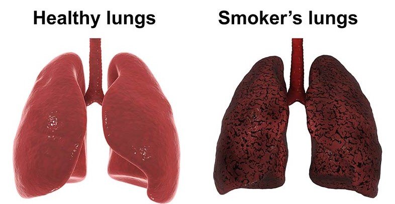 The Short and Long Term Effects of Smoking