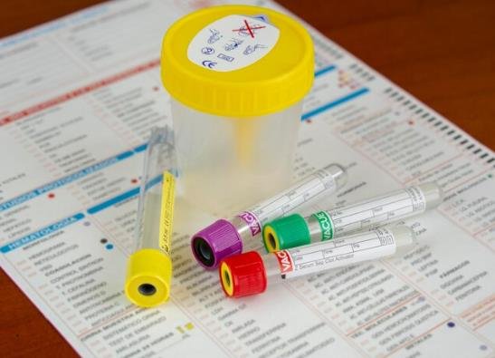 How Much Muriatic Acid to Lower pH: A Dosage Guide