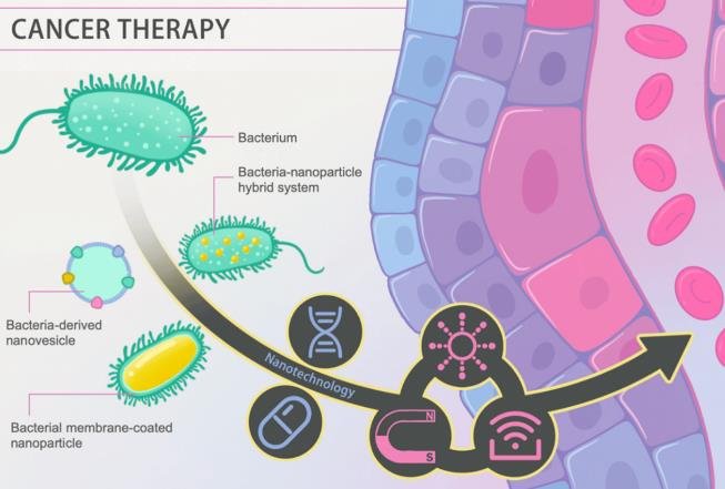 Israeli nanotechnology enhances cancer treatment with light