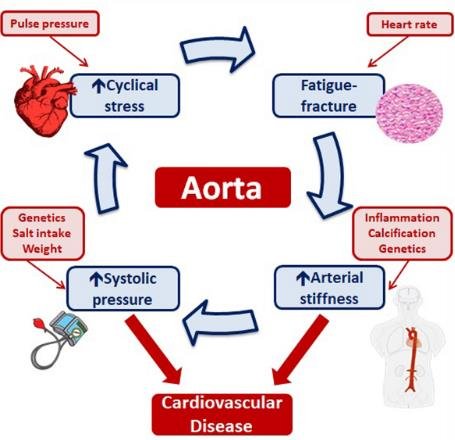 New Drug Improves Arterial Stiffness in Hypertensive Patients