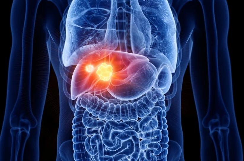 How PRMTs Influence the Immune Response in Liver Cancer