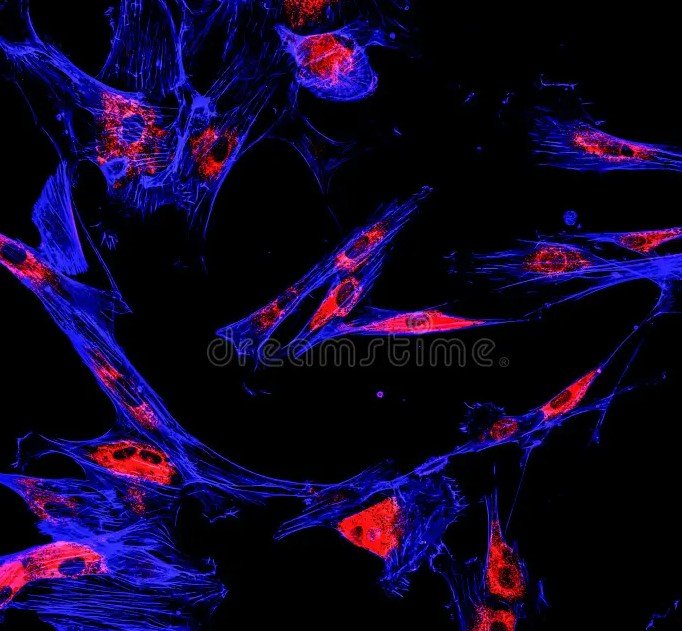 melanoma immunofluorescent microscope image